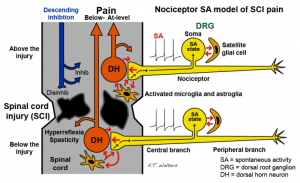 Nociceptor SA model of SCI pain