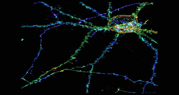 海马神经元尼康SIM图。